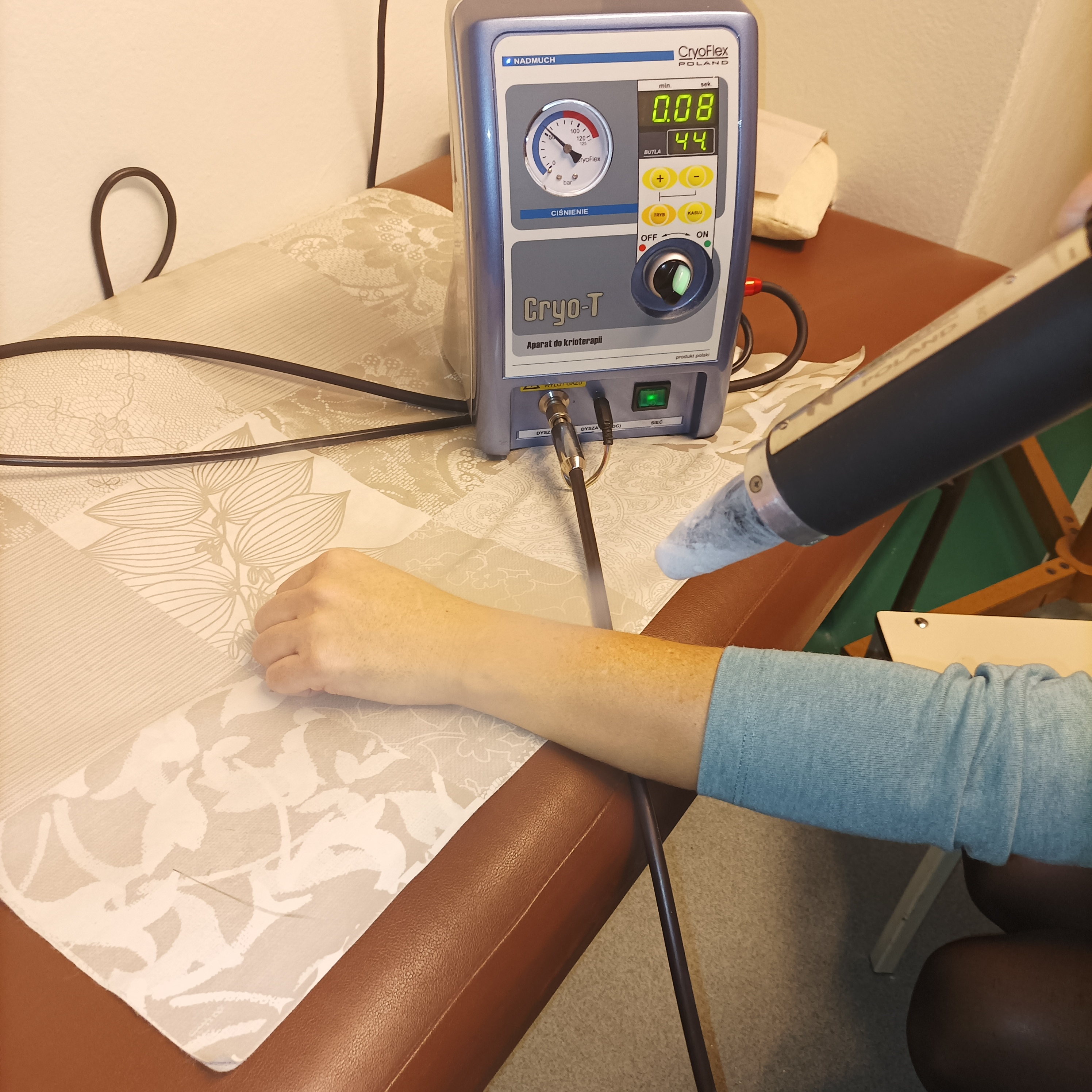 krioterapia