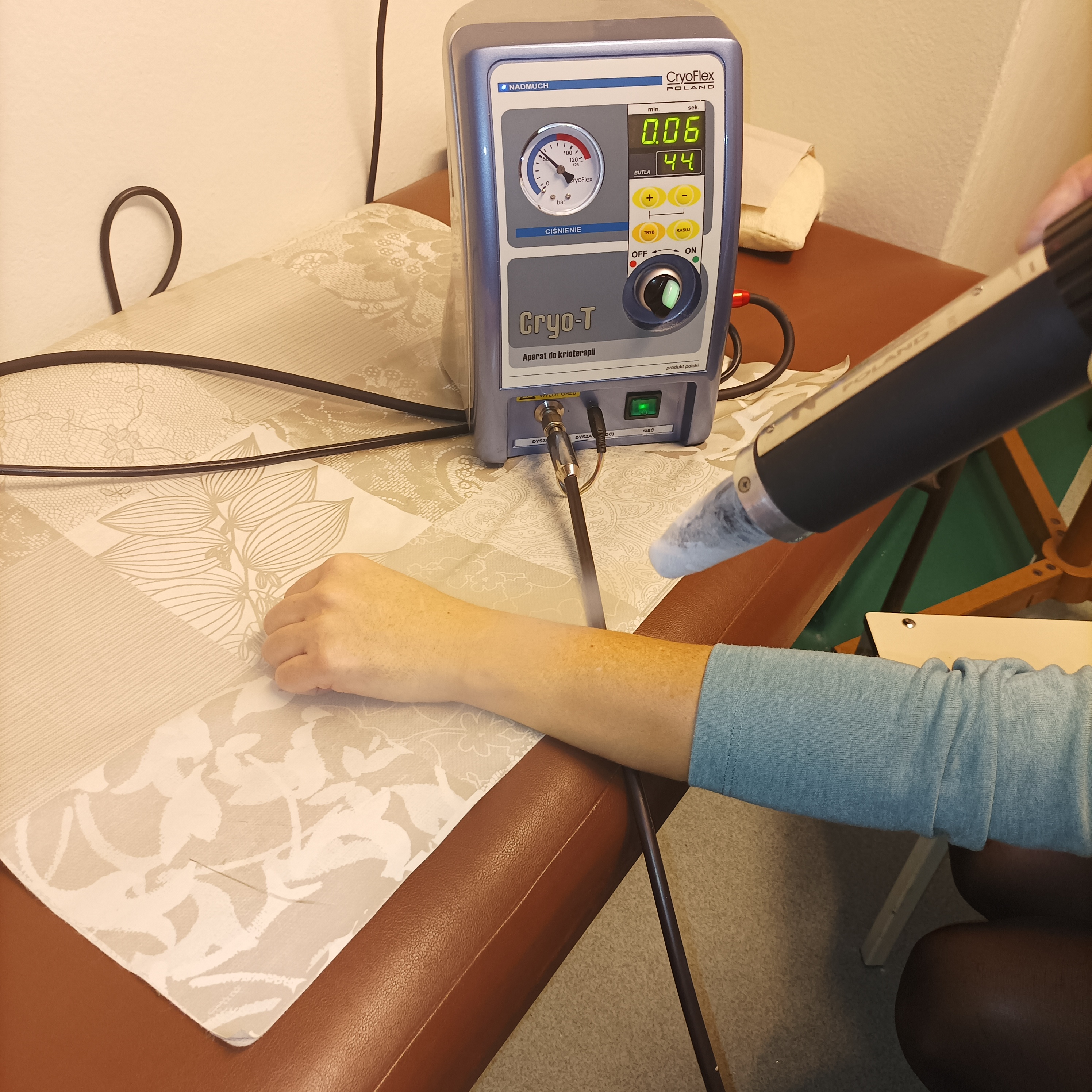 krioterapia
